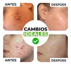 JABÓN DE CURCUMA 100% NATURAL💛🧼